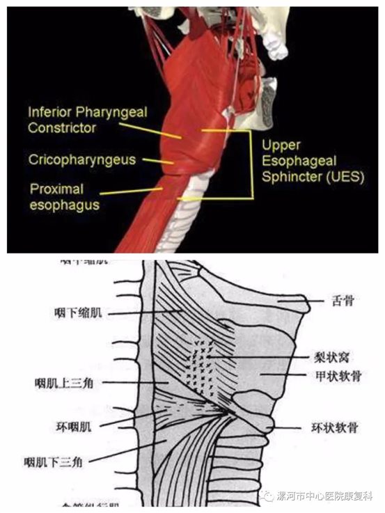 环咽肌扩张术图片