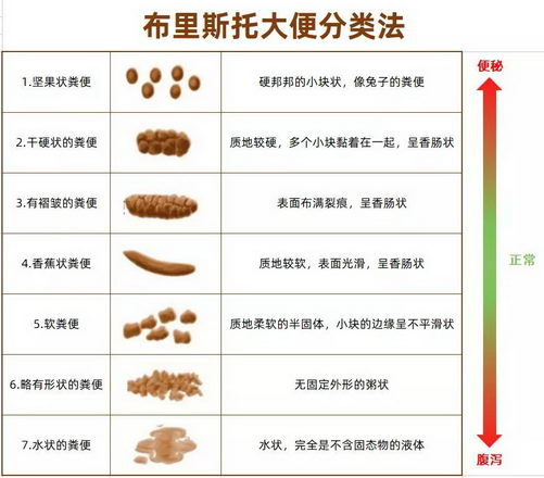 便秘程度的划分 图片图片