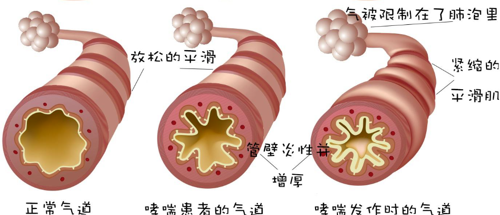 图片 4