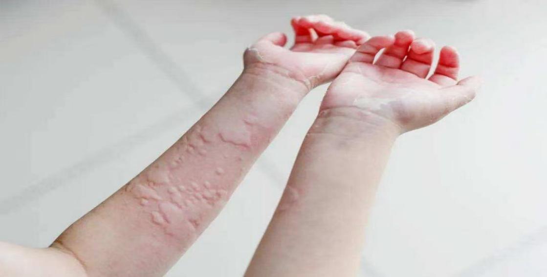 225a3d135711c1c788227602b054cf37