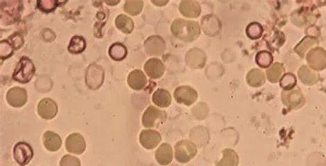 /private/var/mobile/Containers/Data/Application/4494A47D-7093-415A-A026-3639E797C8CB/tmp/insert_image_tmp_dir/2025-04-18 09:28:13.031000.png2025-04-18 09:28:13.031000