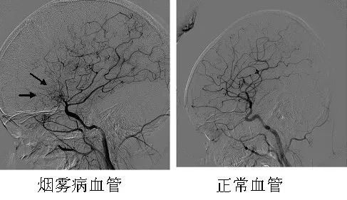 61abf0f8de954d19.png 61abf0f8de954d19.png