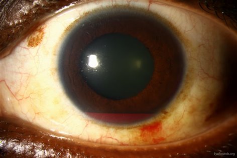 ff3eb3a568feeec87d96a1d3f0e61817 ff3eb3a568feeec87d96a1d3f0e61817