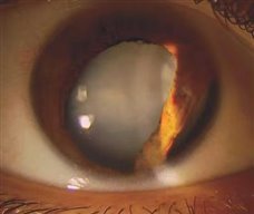 2bd439f17d418f225dbd17ec51a64e3e