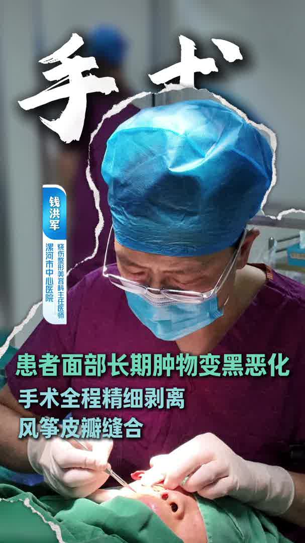 患者面部长期肿物变黑恶化 手术全程剥离采用风筝皮瓣缝合